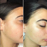 Alluvea™  Facial Hair Removal Cream